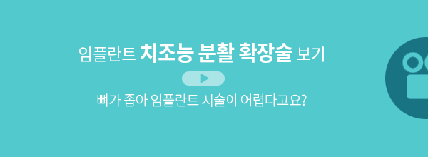 임플란트 치조능 분활 확장술 보기