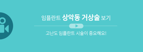 임플란트 상악동 거상술 보기